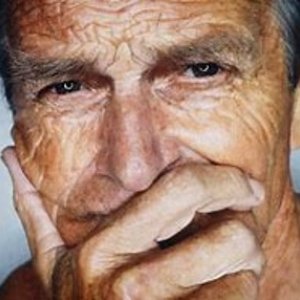 Mature man with sun damage